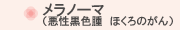メラノーマ（悪性黒色腫　ほくろのがん）
